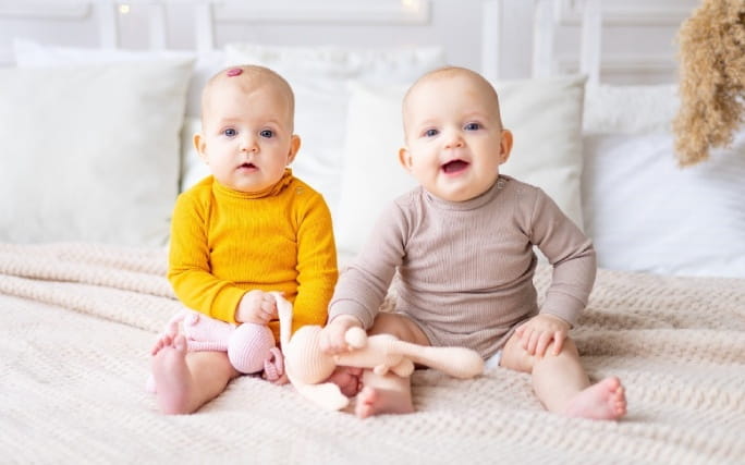 Gémeos sentados numa cama, um deles tem um hemangioma infantil no couro cabeludo.